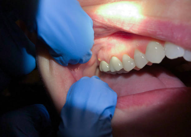 Best Tooth Pain Emergency Relief  in Loma Ri, CA